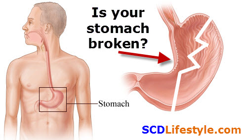 broken-stomach